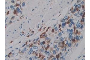 Immunohistochemistry (IHC) image for anti-Protein Tyrosine Phosphatase, Receptor Type, Q (PTPRQ) (AA 36-294) antibody (ABIN7442573)