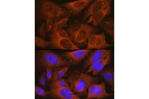 Immunofluorescence analysis of U-2 OS cells using MSMB Rabbit mAb (ABIN1681107, ABIN3018643, ABIN3018644 and ABIN7101636) at dilution of 1:100 (40x lens). (MSMB 抗体)