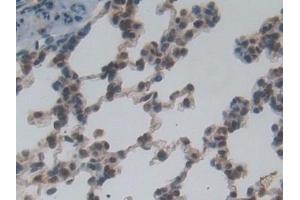 Immunohistochemistry (IHC) image for anti-NME/NM23 Nucleoside Diphosphate Kinase 6 (NME6) (AA 1-173) antibody (ABIN7439435)