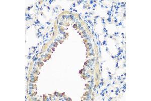 Immunohistochemistry of paraffin-embedded mouse lung using CAV3 antibody at dilution of 1:200 (40x lens). (Caveolin 3 抗体)