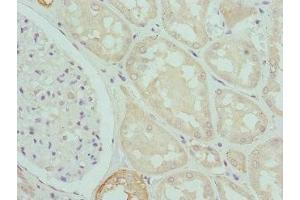 Immunohistochemistry of paraffin-embedded human kidney tissue using ABIN7146779 at dilution of 1:100 (CPN1 抗体  (AA 209-458))