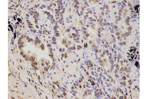 Immunohistochemistry (IHC) image for anti-Proteasome (Prosome, Macropain) 26S Subunit, Non-ATPase, 2 (PSMD2) antibody (ABIN1874389) (PSMD2 抗体)