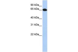 Western Blotting (WB) image for anti-Small Nuclear Ribonucleoprotein 70kDa (U1) (SNRNP70) antibody (ABIN2462137) (SNRNP70 抗体)