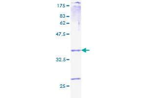 Prokineticin 1 Protein (Prok1) (AA 1-105) (GST tag)