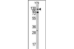Western blot analysis of ABL1 Antibody (N-term ) (ABIN392079 and ABIN2841839) in Y79 cell line lysates (35 μg/lane). (ABL1 抗体  (N-Term))
