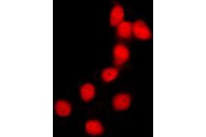 Immunofluorescent analysis of Histone H2B staining in HeLa cells. (Histone H2B 抗体  (N-Term))