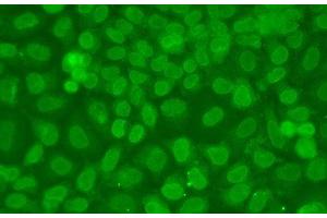 Immunofluorescence analysis of A549 cells using TARBP2 Polyclonal Antibody (TARBP2 抗体)