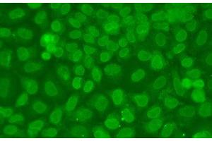 Immunofluorescence analysis of A549 cells using TARBP2 Polyclonal Antibody (TARBP2 抗体)