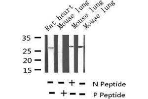 Western blot analysis of Phospho-p27 Kip1 (Ser10) expression in various lysates (CDKN1B 抗体  (pSer10))