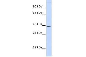 FAM76B antibody used at 1 ug/ml to detect target protein. (FAM76B 抗体  (Middle Region))