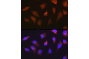 Immunofluorescence analysis of HeLa cells using PSM Rabbit mAb (ABIN7269597) at dilution of 1:100 (40x lens). (PSMA2 抗体)