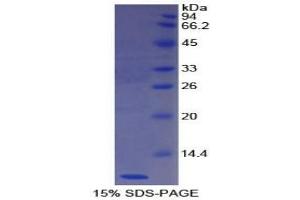 SDS-PAGE analysis of Human Nesfatin 1 Protein. (NUCB2 蛋白)