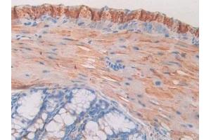 Detection of MAOA in Mouse Colon Tissue using Polyclonal Antibody to Monoamine Oxidase A (MAOA) (Monoamine Oxidase A 抗体  (AA 229-428))