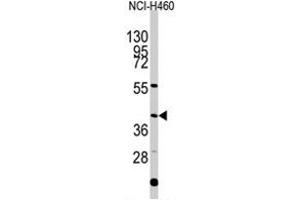Western blot analysis of EN1 polyclonal antibody  in NCI-H460 cell line lysates (35 ug/lane). (EN1 抗体  (N-Term))