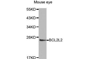 Western Blotting (WB) image for anti-BCL2-Like 2 (BCL2L2) (AA 1-193) antibody (ABIN3021581) (BCL2L2 抗体  (AA 1-193))