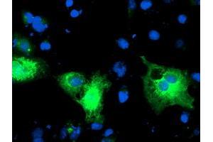 Image no. 1 for anti-Protein Disulfide Isomerase Family A, Member 4 (PDIA4) antibody (ABIN1500108) (PDIA4 抗体)