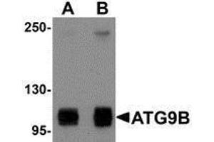 Western Blotting (WB) image for anti-Autophagy Related 9B (ATG9B) (C-Term) antibody (ABIN2477542) (ATG9B 抗体  (C-Term))