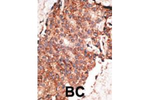 Immunohistochemistry (IHC) image for anti-Bone Morphogenetic Protein 1 (BMP1) antibody (ABIN2999234) (BMP1 抗体)