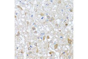 Immunohistochemistry of paraffin-embedded rat brain using EFHC1 antibody at dilution of 1:100 (x40 lens). (EFHC1 抗体)