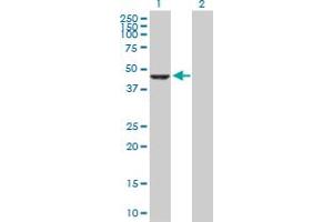 Western Blot analysis of CPA2 expression in transfected 293T cell line by CPA2 MaxPab polyclonal antibody. (Carboxypeptidase A2 抗体  (AA 1-417))