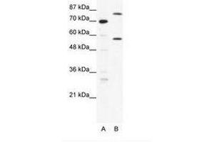 Image no. 1 for anti-Myoneurin (MYNN) (AA 371-420) antibody (ABIN202811) (Myoneurin 抗体  (AA 371-420))