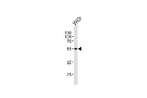 Western blot analysis of lysate from WiDr cell line, using hPDX1 (ABIN388773 and ABIN2839108). (PDX1 抗体  (C-Term))