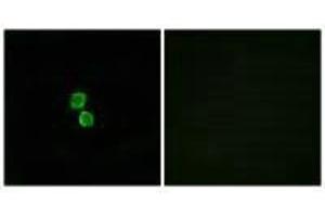 Immunofluorescence analysis of MCF-7 cells, using CKLF1 antibody. (CMTM1 抗体)