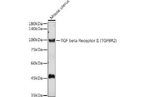 Western blot analysis of extracts of Mouse uterus, using TGF beta Receptor II (TGF beta Receptor II (TGFBR2)) antibody (ABIN6130735, ABIN6149085, ABIN6149088 and ABIN6215477) at 1:1000 dilution. (TGFBR2 抗体  (AA 23-280))