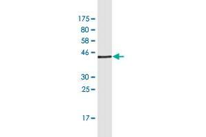 Western Blotting (WB) image for anti-Formin 1 (FMN1) (AA 1-109) antibody (ABIN949949)