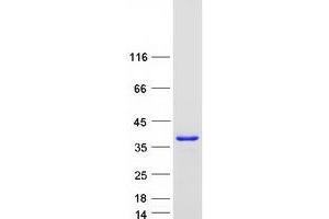 Validation with Western Blot