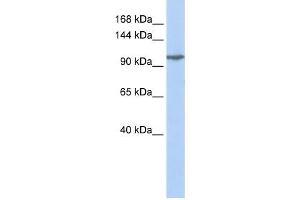 GRIK5 antibody used at 1 ug/ml to detect target protein.