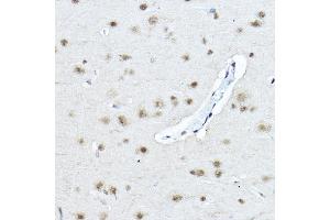 Immunohistochemistry of paraffin-embedded rat brain using Twist Rabbit pAb (ABIN6133951, ABIN6149713, ABIN6149716 and ABIN6220170) at dilution of 1:200 (40x lens). (TWIST1 抗体  (AA 1-100))