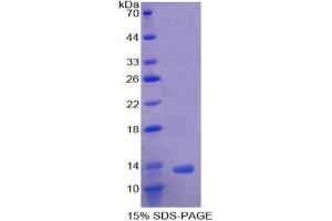 SDS-PAGE analysis of Human ACVR1B Protein. (Activin A Receptor Type IB/ALK-4 蛋白)
