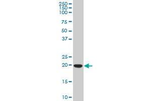 CBFB polyclonal antibody (A01), Lot # 050928JC01 Western Blot analysis of CBFB expression in Jurkat .