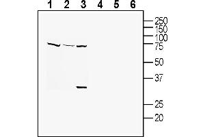 Western blot analysis of human  monocytic leukemia cell line lysates (lanes 1 and 4), human HUVEC endothelial cell line lysates (lanes 2 and 5) and mouse  microglia cell line lysate:1-3. (Tetraspanin 18 抗体  (Extracellular))