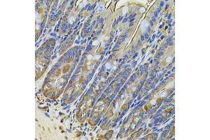 Immunohistochemistry of paraffin-embedded mouse intestine using NAA50 Antibody (ABIN5975518) at dilution of 1/100 (40x lens). (NAA50 抗体)