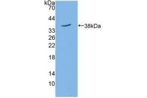 Detection of Recombinant SIRT6, Mouse using Polyclonal Antibody to Sirtuin 6 (SIRT6) (SIRT6 抗体  (AA 1-334))