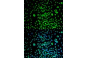 Immunofluorescence analysis of U20S cell using MAX antibody. (MAX 抗体  (AA 1-160))