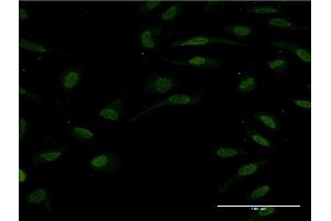 Immunofluorescence of monoclonal antibody to HNF1B on HeLa cell. (HNF1B 抗体  (AA 29-118))