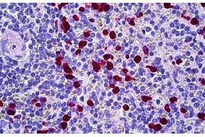 Human Spleen: Formalin-Fixed, Paraffin-Embedded (FFPE) (HGS 抗体  (AA 451-500))