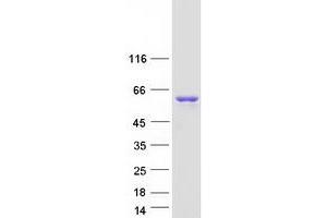 Western Blotting (WB) image for Nuclear Receptor Coactivator 1 (NCOA1) (Transcript Variant 1) protein (Myc-DYKDDDDK Tag) (ABIN2732659)