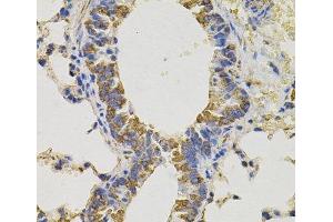 Immunohistochemistry of paraffin-embedded Mouse lung using PTPRC Polyclonal Antibody (CD45 抗体)