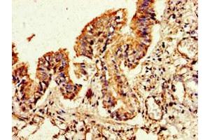 Immunohistochemistry of paraffin-embedded human lung tissue using ABIN7153171 at dilution of 1:100 (FLI1 抗体  (AA 205-331))