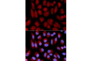 Immunofluorescence analysis of U2OS cell using TAP2 antibody. (TAP2 抗体)