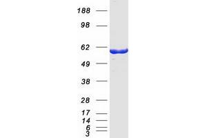 Validation with Western Blot