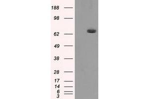 HEK293T cells were transfected with the pCMV6-ENTRY control (Left lane) or pCMV6-ENTRY HDAC10 (Right lane) cDNA for 48 hrs and lysed. (HDAC10 抗体)