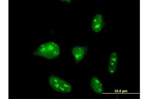 Immunofluorescence of monoclonal antibody to ZNF611 on HeLa cell. (ZNF611 抗体  (AA 1-151))