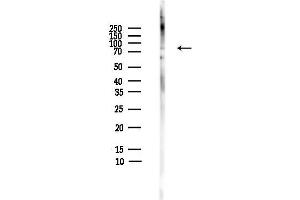 anti-Protein Arginine Methyltransferase 7 (PRMT7) (Internal Region) antibody