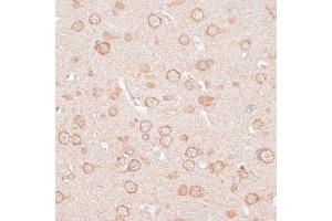 Immunohistochemistry (IHC) image for anti-Potassium Inwardly-Rectifying Channel, Subfamily J, Member 4 (KCNJ4) (AA 50-150) antibody (ABIN6142734)