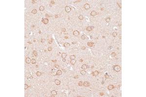 Immunohistochemistry of paraffin-embedded rat brain using KCNJ4 antibody (ABIN6134096, ABIN6142734, ABIN6142737 and ABIN6218214) at dilution of 1:100 (40x lens). (KCNJ4 抗体  (AA 50-150))